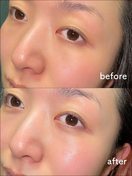 LEA SKINER/cliento/化粧水を使ったクチコミ(5枚目)