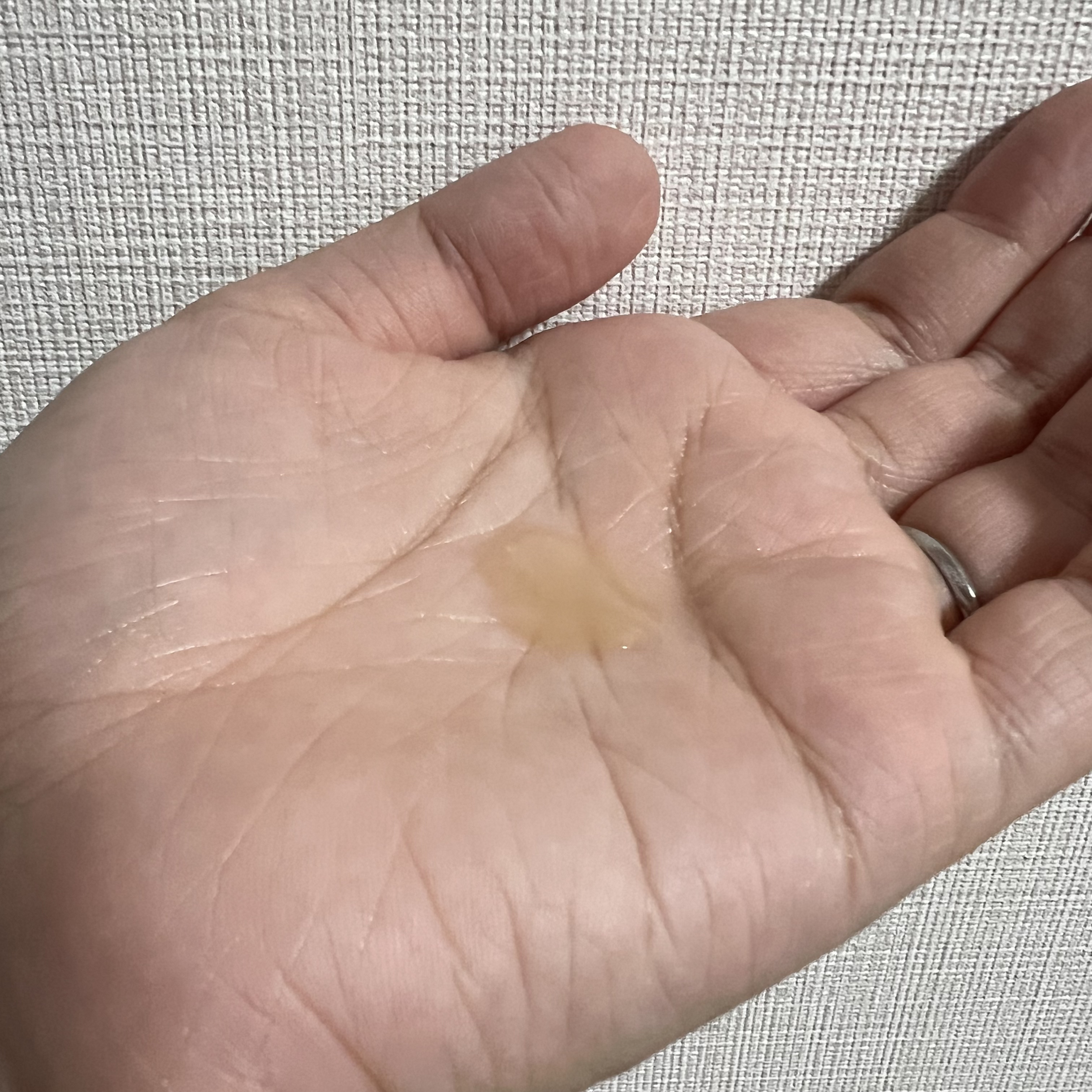 ビフィダバイオーム コンセントレート セラム/manyo/美容液を使ったクチコミ（2枚目）