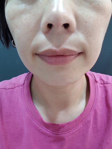 角質スッキリ毛穴パック /HANYUL(ハンユル)/洗い流すパック・マスクを使ったクチコミ(6枚目)