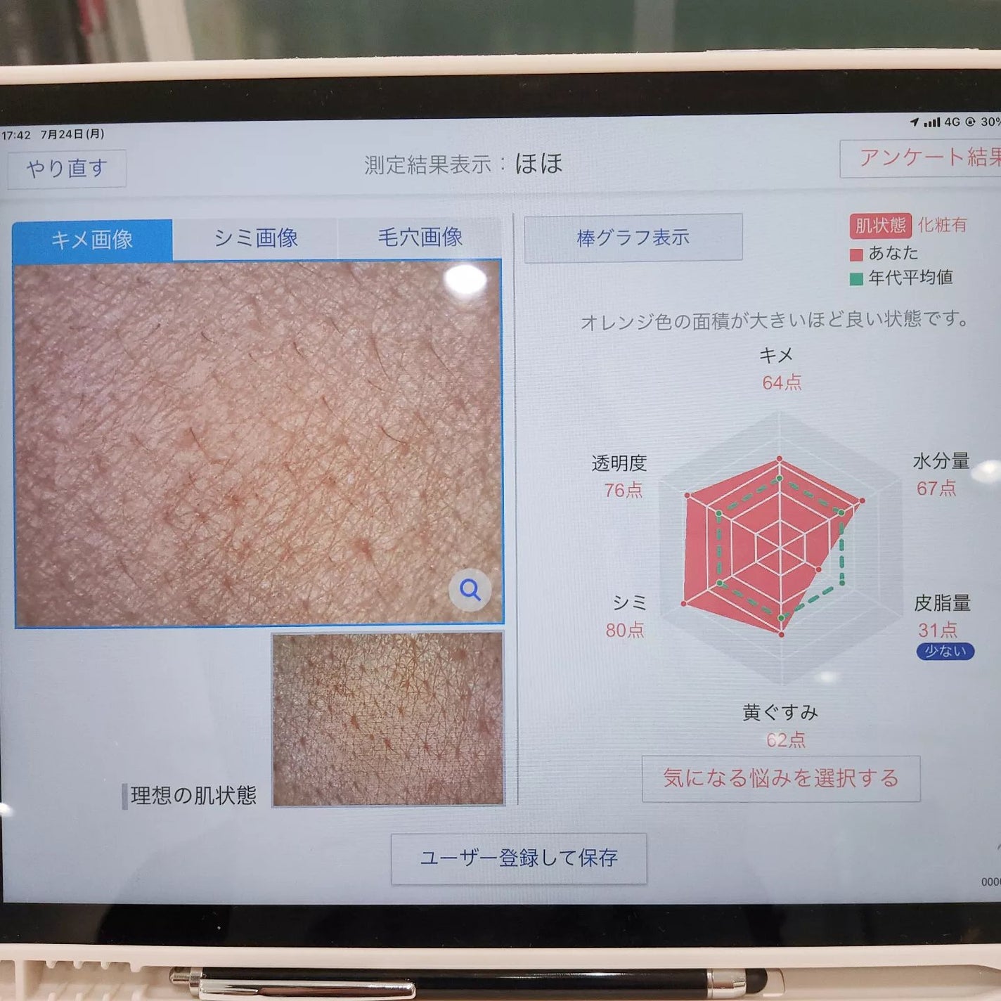 肌遺伝子検査キット MY SKIN ID/MY SKIN ID/遺伝子検査キットを使ったクチコミ(7枚目)