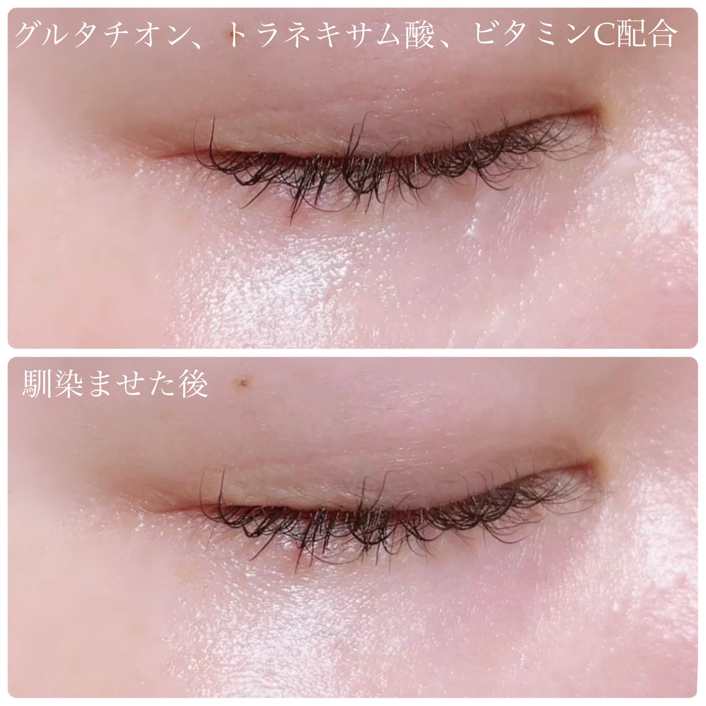 ナイアシンアミドビタミンC ブライトニングマスク/MARY&MAY/シートマスク・パックを使ったクチコミ(8枚目)