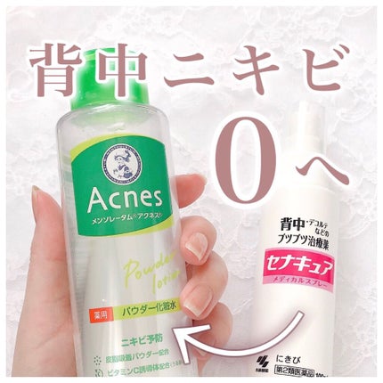 薬用パウダー化粧水/メンソレータム アクネス/化粧水を使ったクチコミ(1枚目)