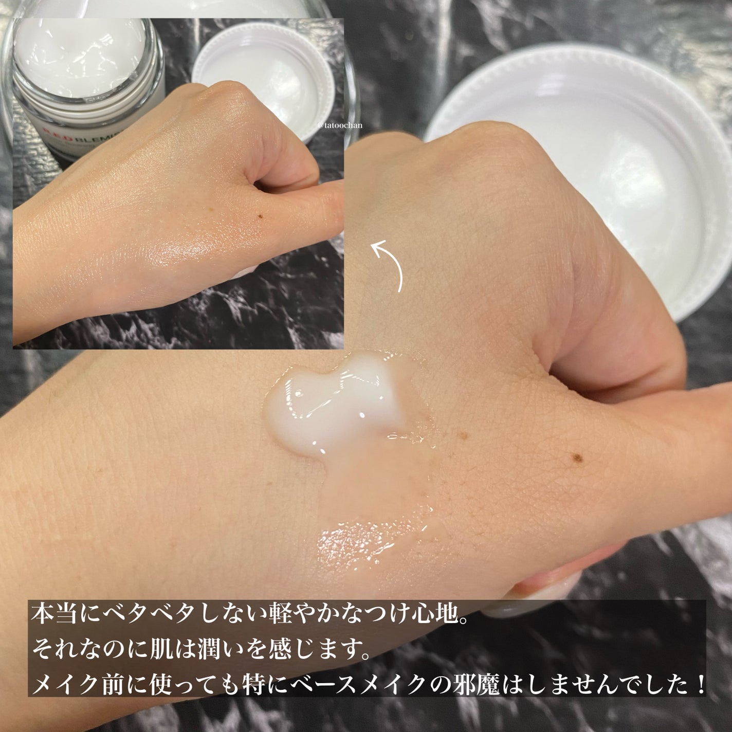 レッドブレミッシュ クリアスージングクリーム/Dr.G/フェイスクリームを使ったクチコミ(3枚目)