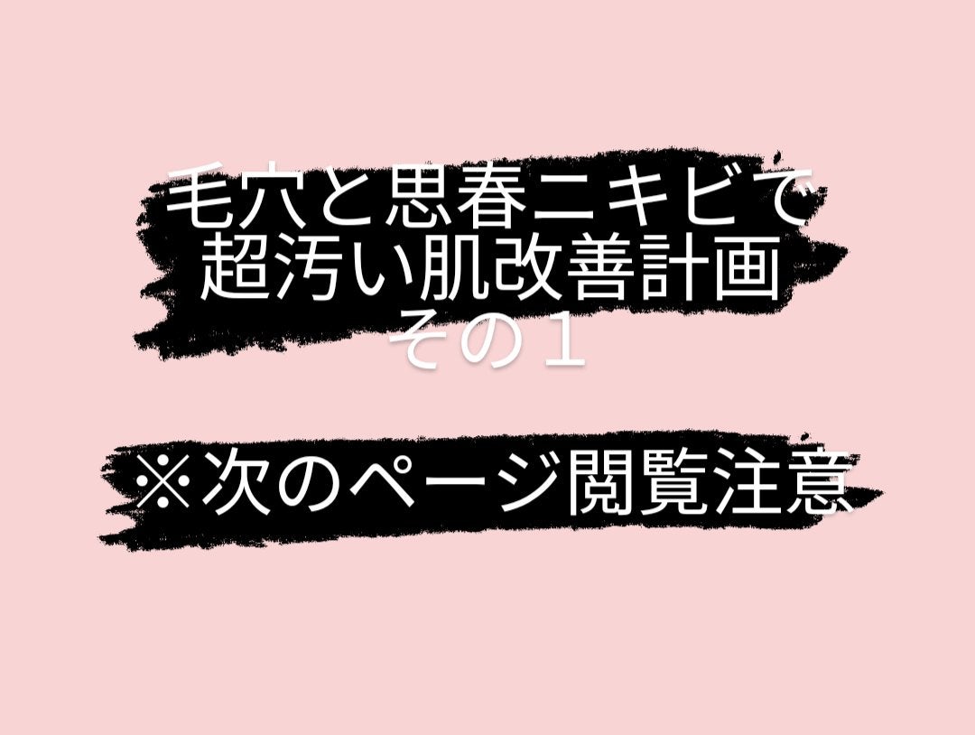 DHC ビタミンCハードカプセル/DHC/美容サプリメントを使ったクチコミ(1枚目)