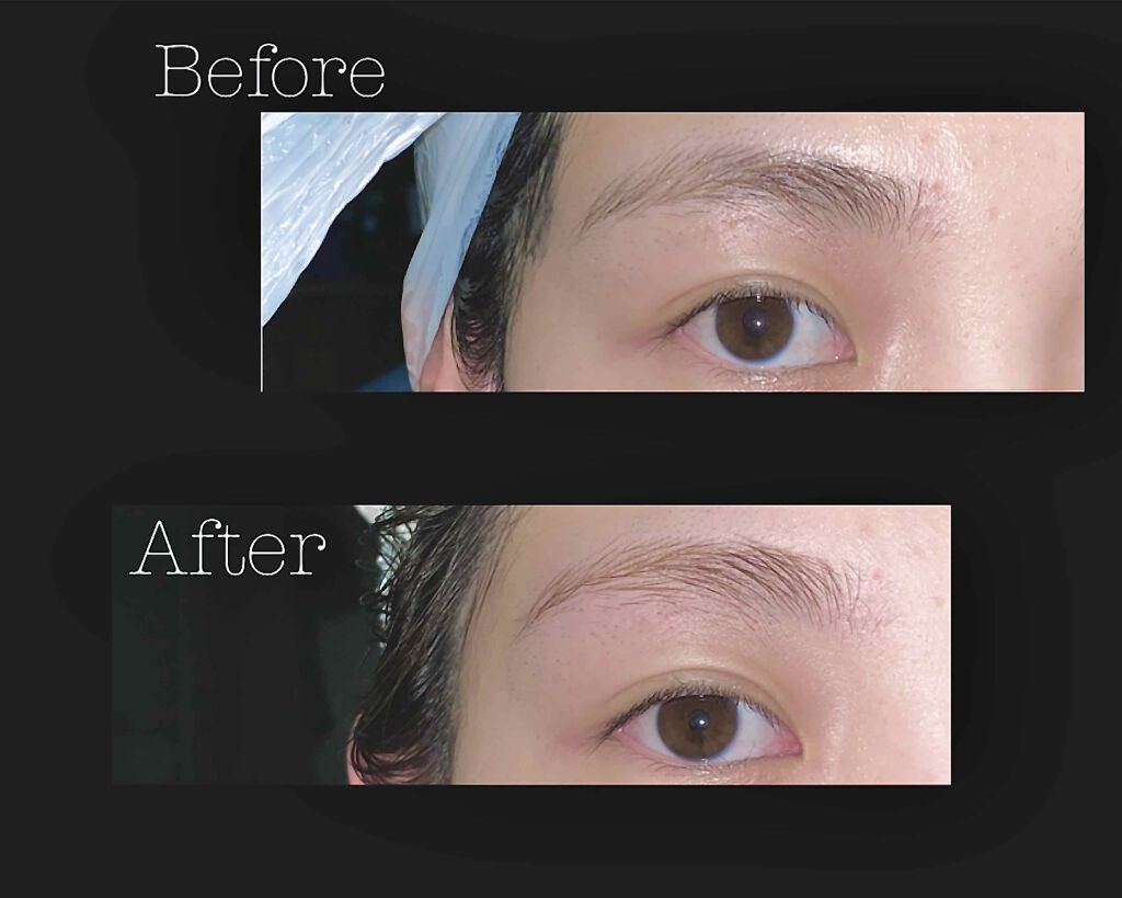 脱色クリーム スピーディー/エピラット/ムダ毛ケアを使ったクチコミ(2枚目)