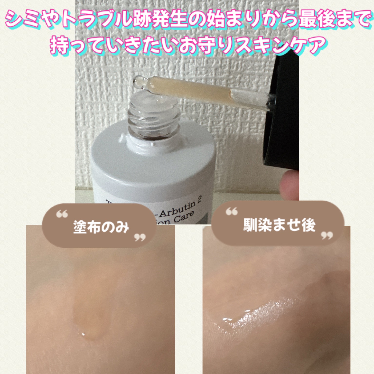 RXザ・アルファアルブチン2 ニキビ跡ケアセラム/COSRX/美容液を使ったクチコミ（2枚目）