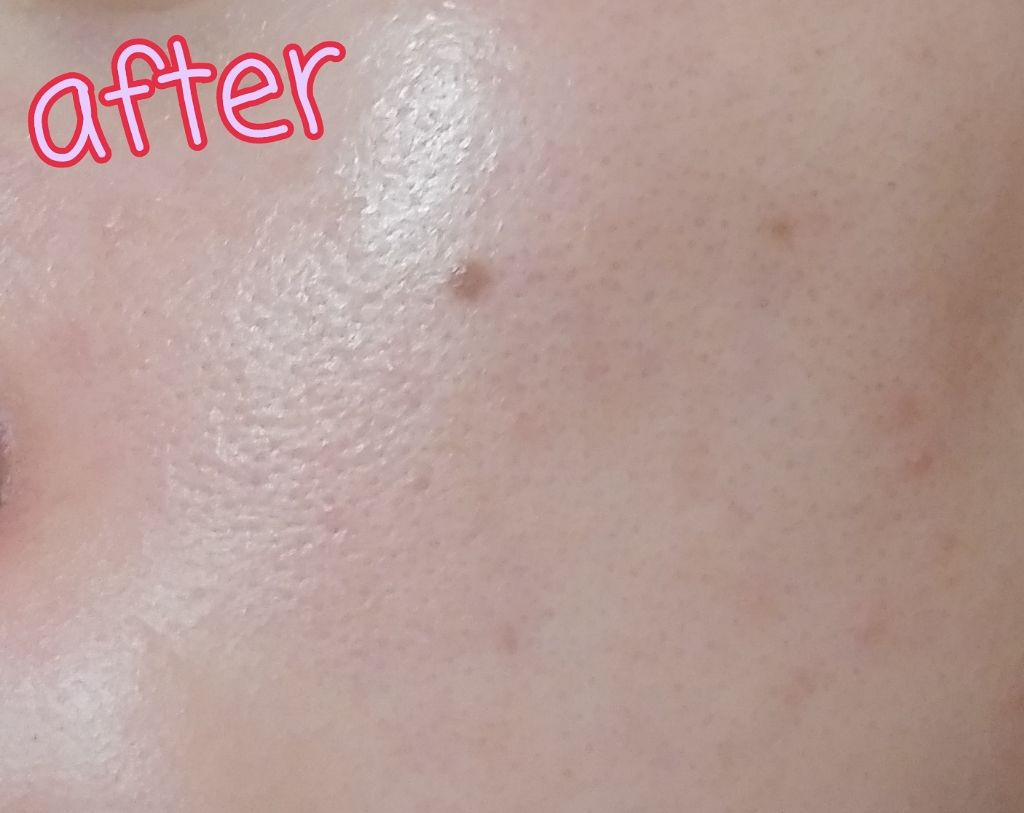 薬用 クリアローション M(しっとりタイプ)/オルビス/化粧水を使ったクチコミ(3枚目)