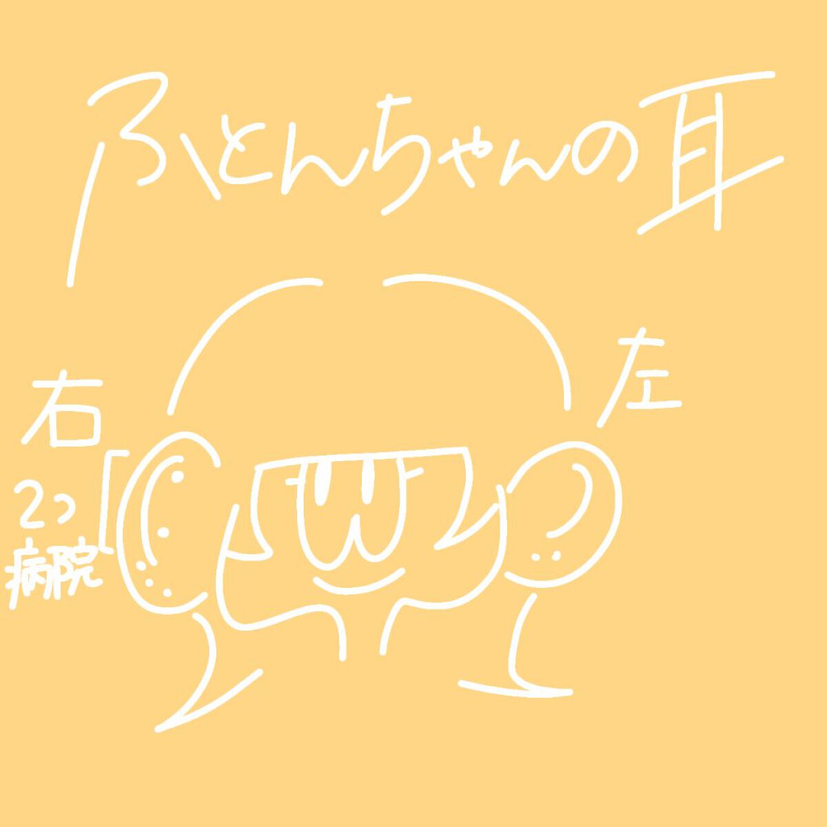 ピアッサー/ピナック/その他を使ったクチコミ（2枚目）