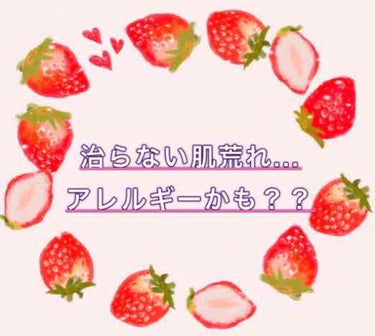 化粧水・敏感肌用・しっとりタイプ/無印良品/化粧水を使ったクチコミ（1枚目）