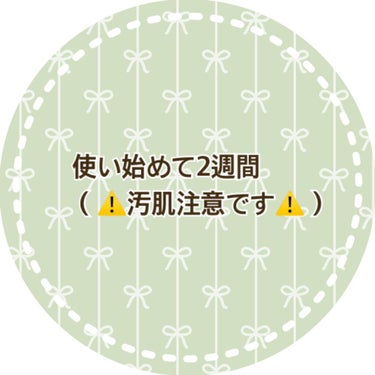 
こんにちは
ゆらです💫


以前スキンケアを気になるものに一新し、
色々試しているところですが
2週間ほど経ったので
載せてみようかなと思います☺️
参考になれば幸いです🍀
⚠️汚肌注意です
 
今使