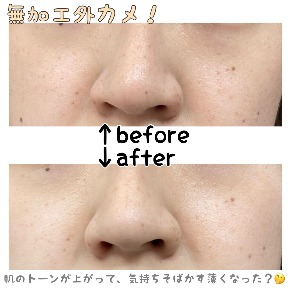 グリーンタンジェリン ビタCダークスポットケアパッド/goodal/トナーパッドを使ったクチコミ（2枚目）