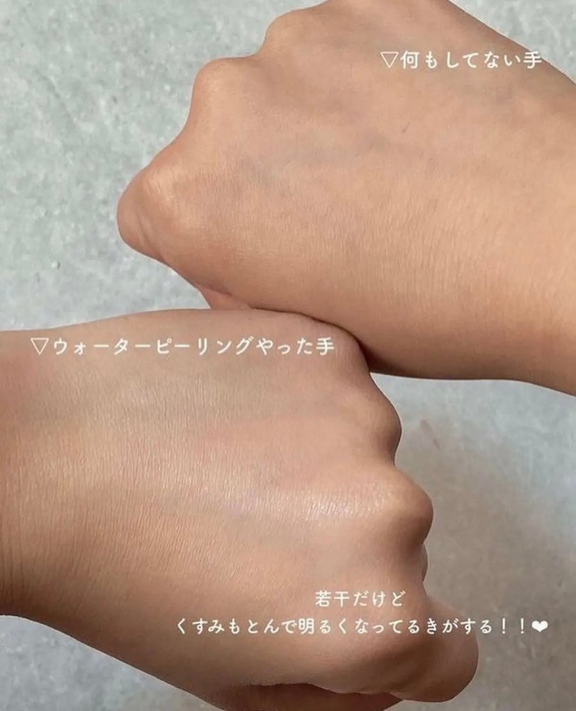 アクアピールクリア/TBC/美顔器・マッサージを使ったクチコミ(5枚目)