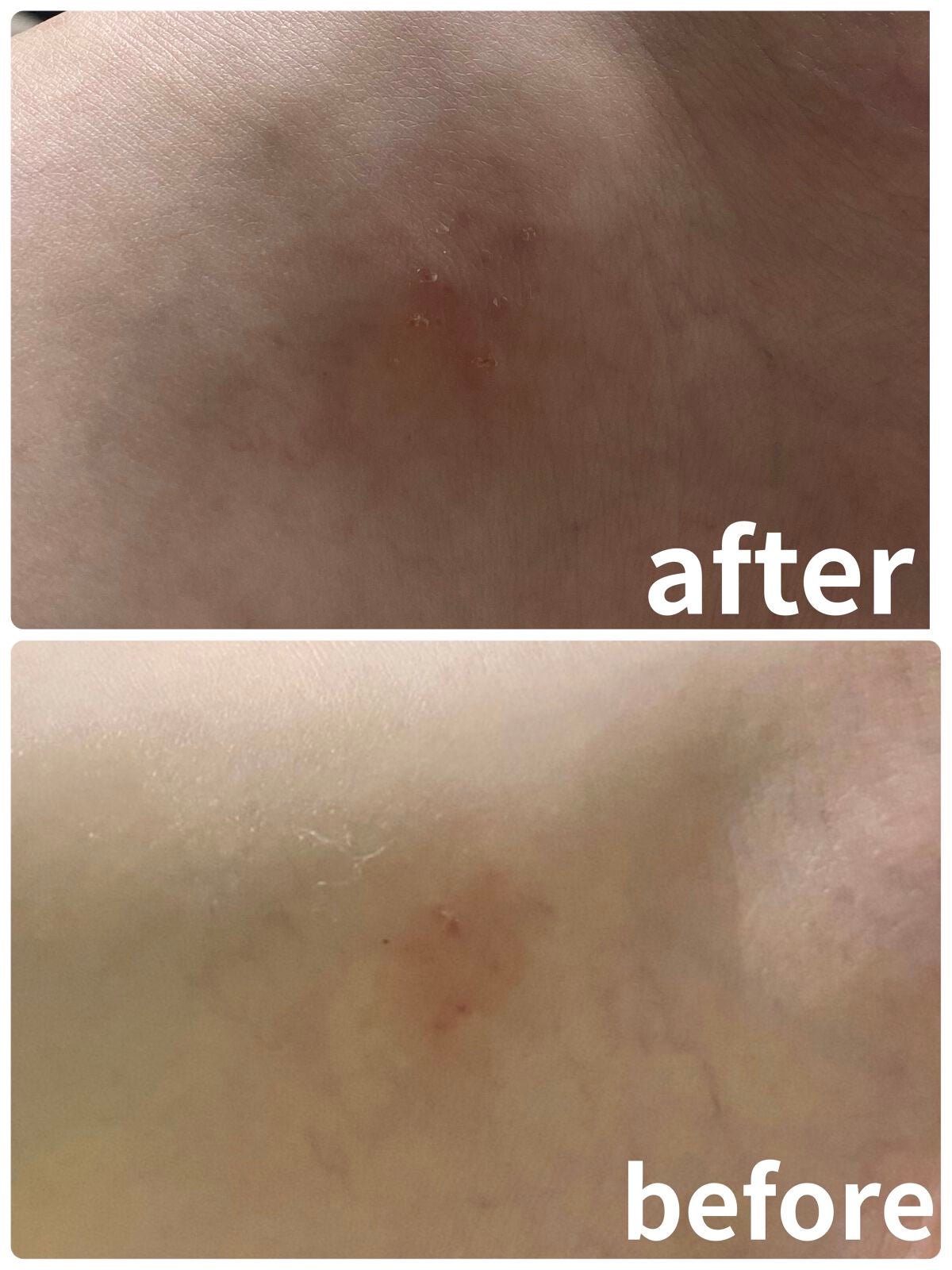 化粧水・敏感肌用・高保湿タイプ/無印良品/化粧水を使ったクチコミ(4枚目)