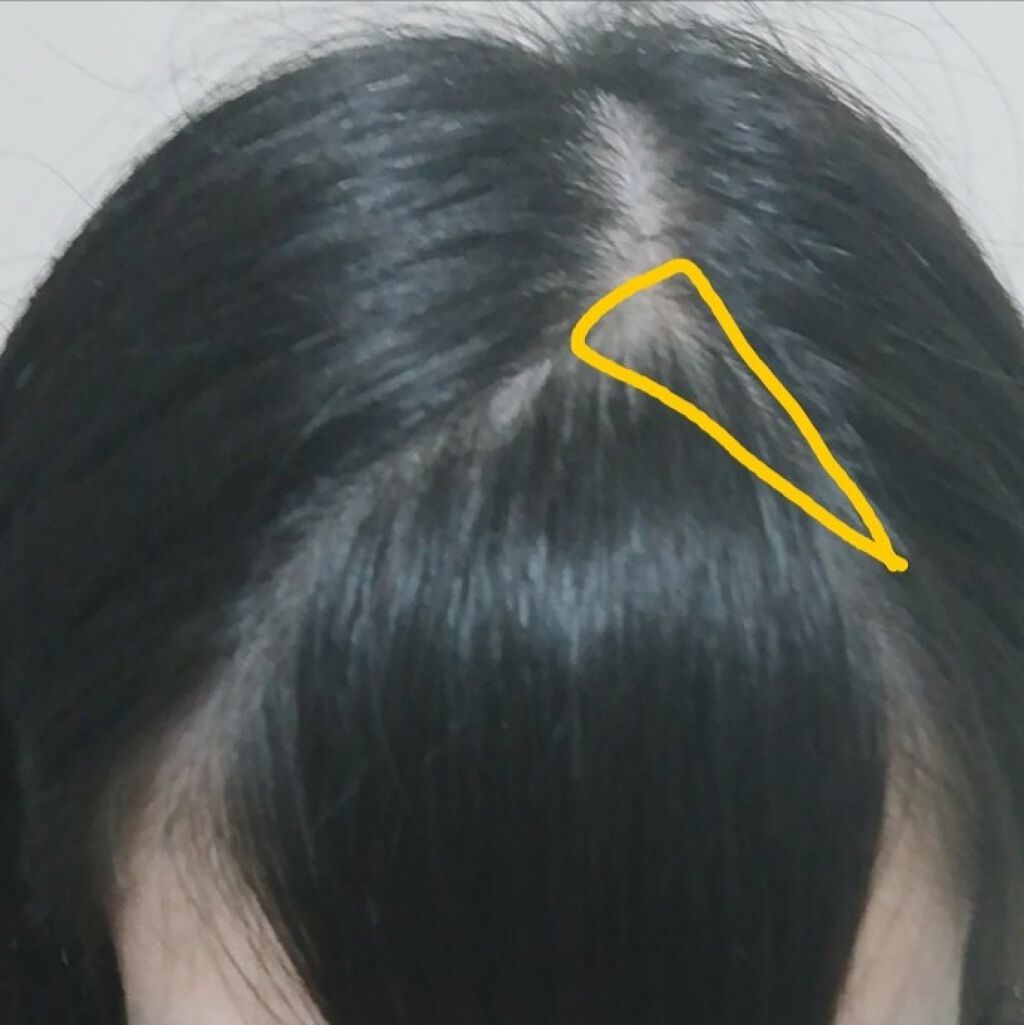 あず ⸜❤︎⸝ on LIPS 「どうも!!あずです!!2日連続投稿するとは思ってなくて自分でも..」(3枚目)