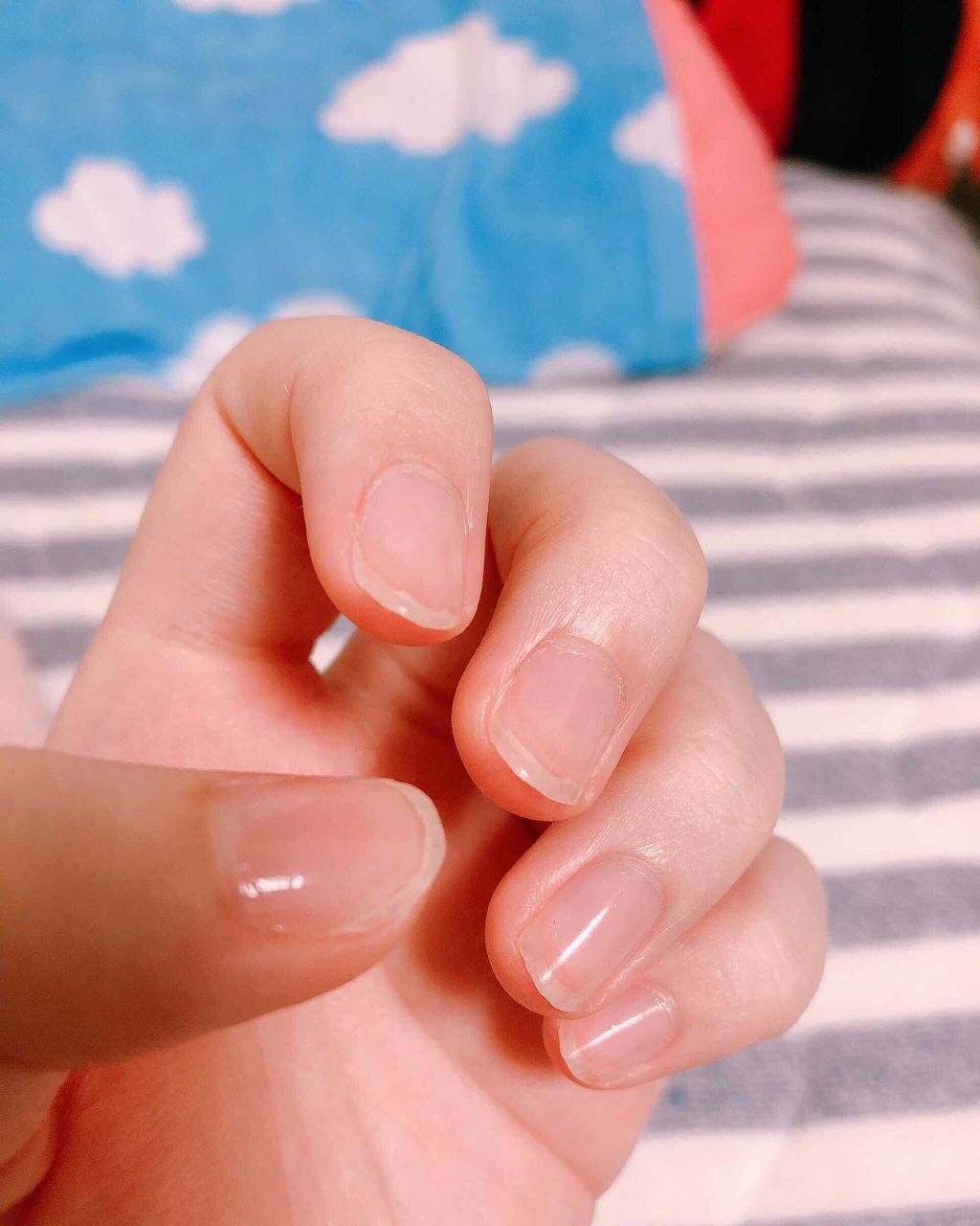 ネイルサポート Na/ネイルネイル/ネイルトップコートを使ったクチコミ（2枚目）