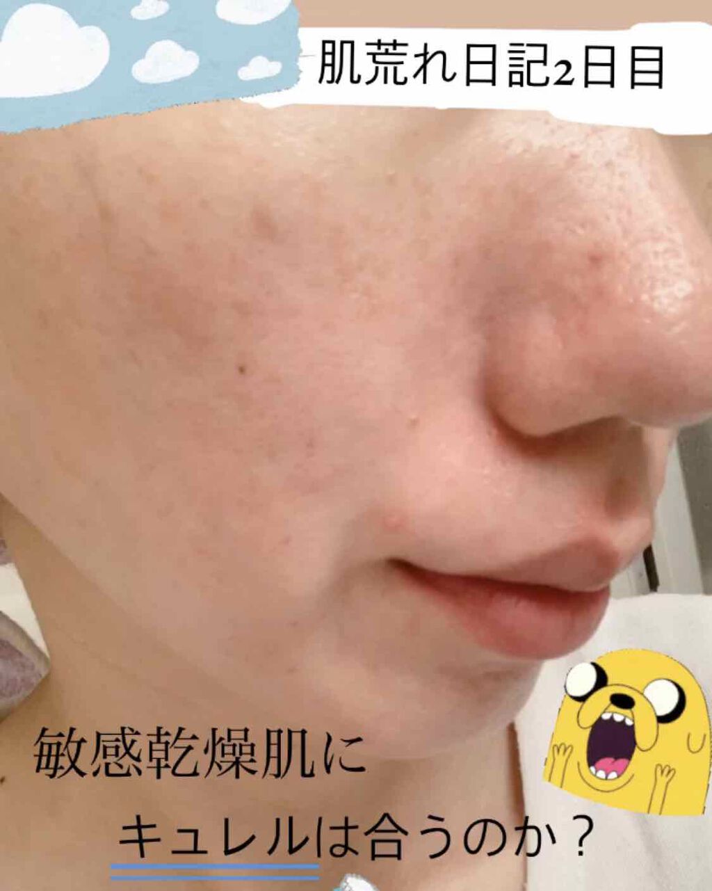 ウオーター/アベンヌ/ミスト状化粧水を使ったクチコミ（1枚目）