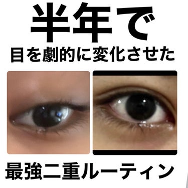 二重マッサージ】 話題沸騰中のコスメ〜真似したいメイク方法の口コミ