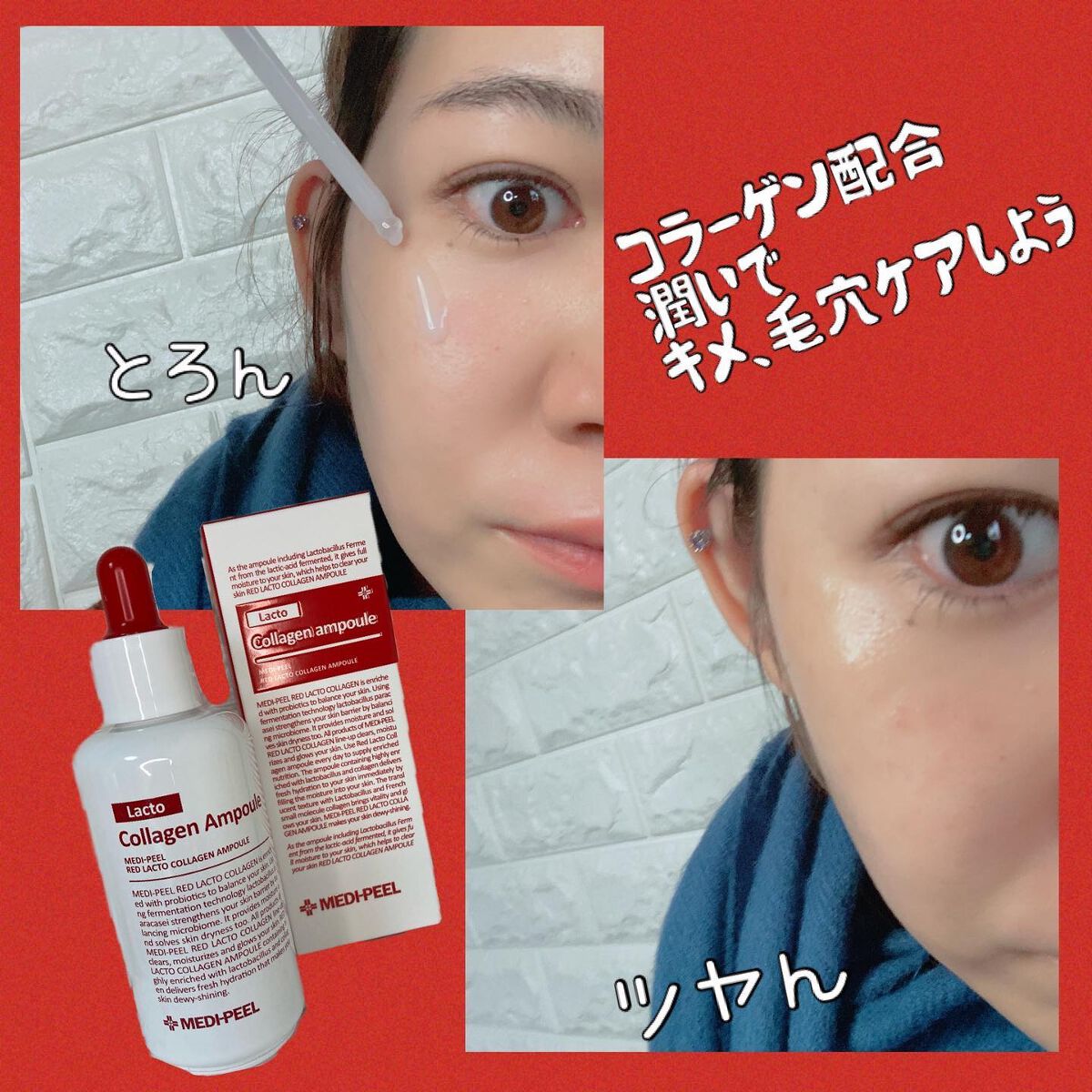 レッドラクトコラーゲンアンプル/MEDIPEEL/美容液を使ったクチコミ（3枚目）