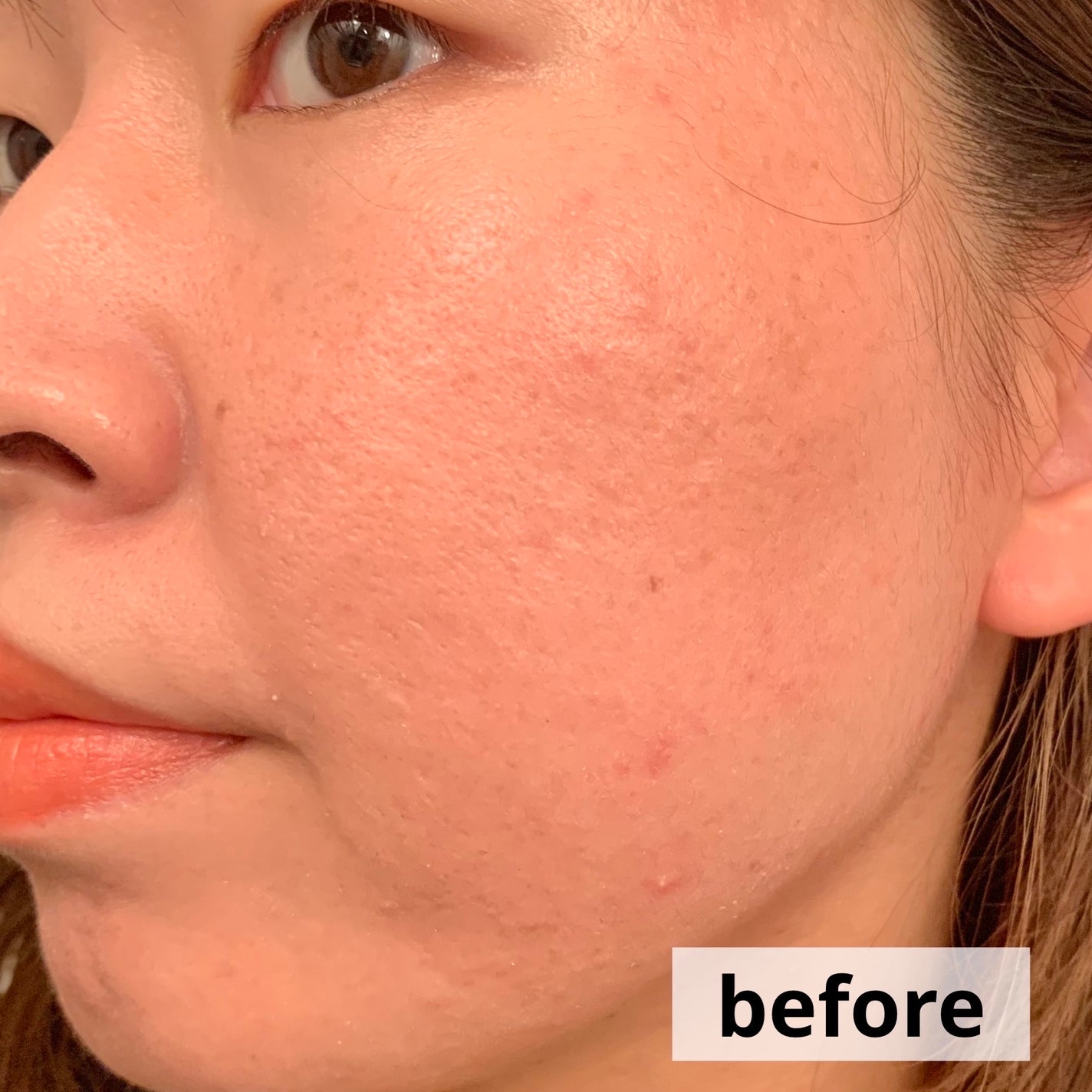 ディオールスキン フォーエヴァー フルイド グロウ/Dior/リキッドファンデーションを使ったクチコミ(6枚目)