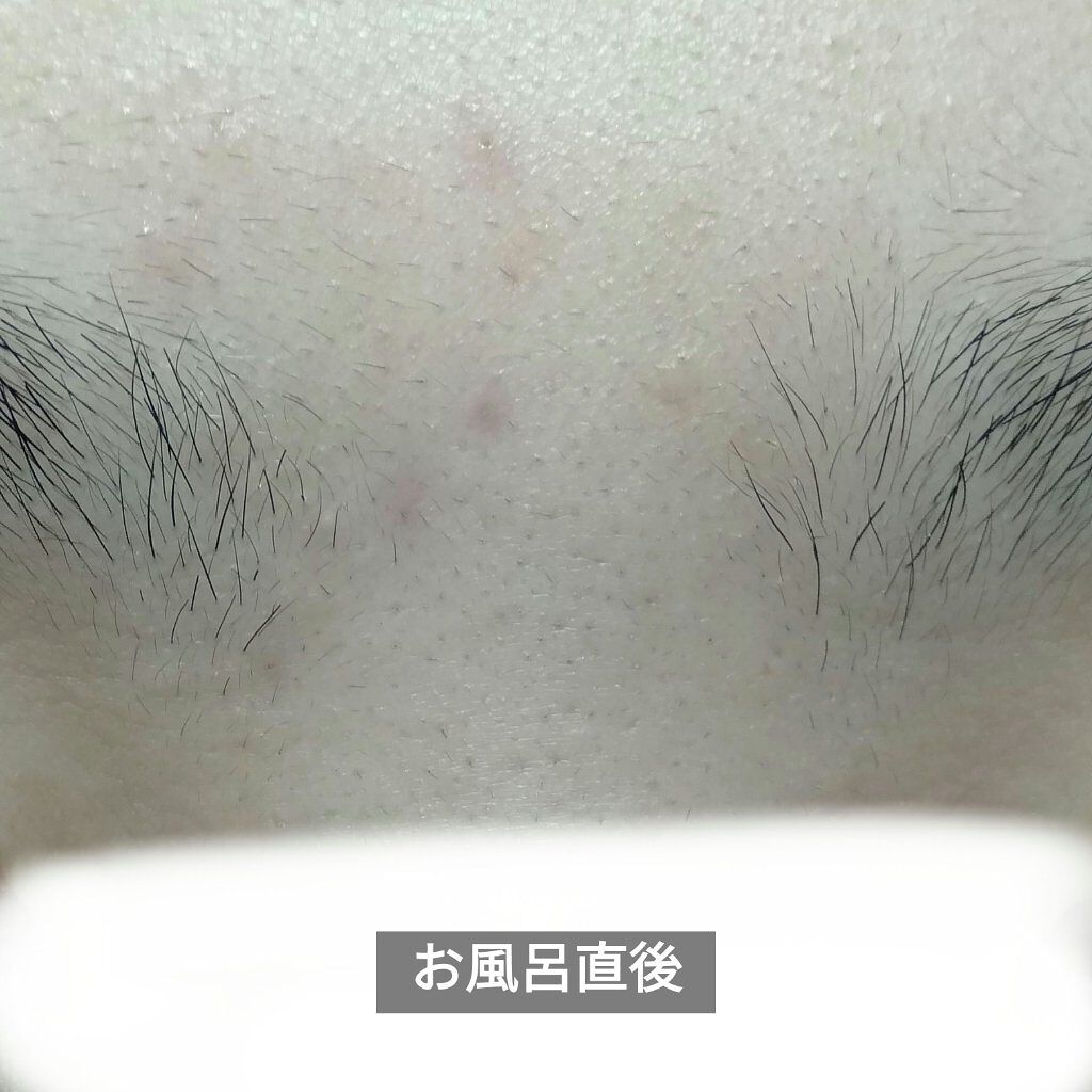 ミルキュア ピュア ウォッシュ&パウダー/ハウス オブ ローゼ/洗顔パウダーを使ったクチコミ(7枚目)