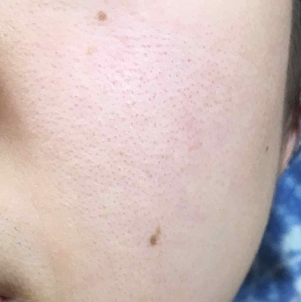 ハトムギ化粧水(ナチュリエ スキンコンディショナー R )/ナチュリエ/化粧水を使ったクチコミ(3枚目)