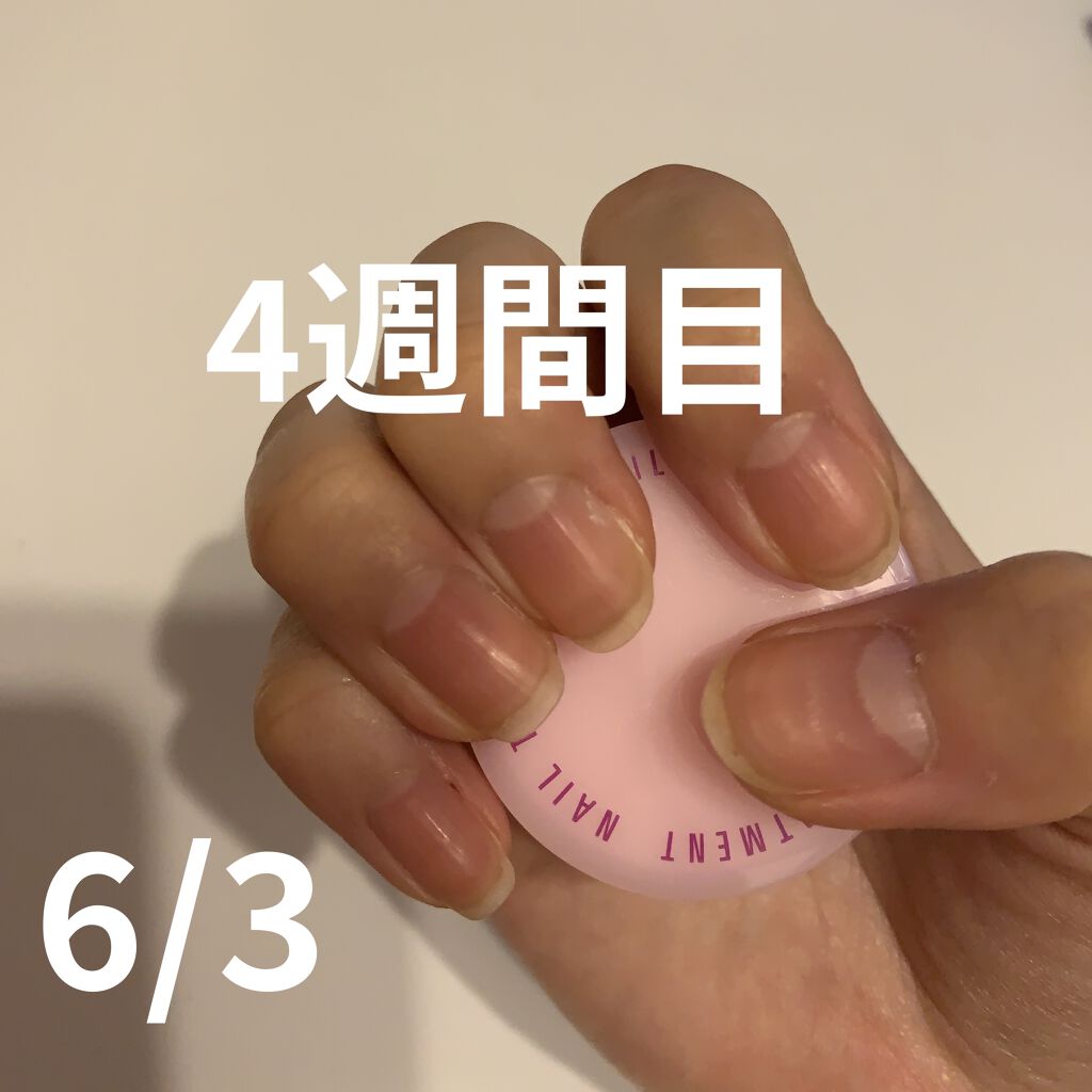 ネイルトリートメント N/ネイルネイル/ネイルオイル・トリートメントを使ったクチコミ（3枚目）