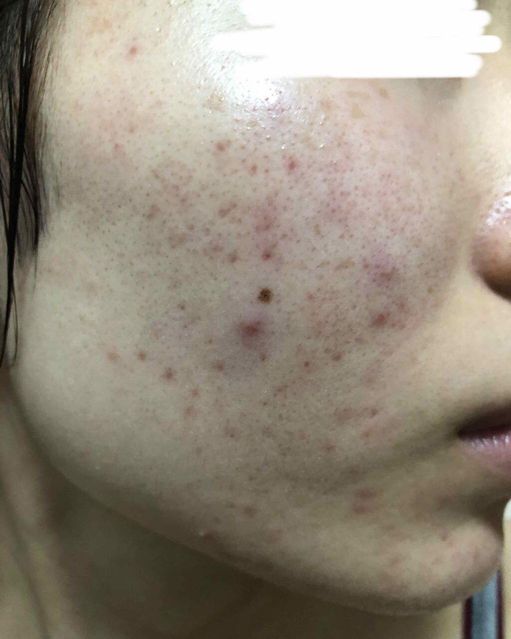 ロゼット 洗顔パスタ ガスールブライト/ロゼット/洗顔フォームを使ったクチコミ(3枚目)