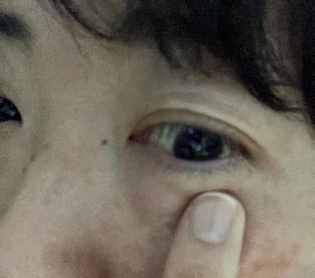 レチノール0.1%クリーム/Frankly/フェイスクリームを使ったクチコミ(4枚目)