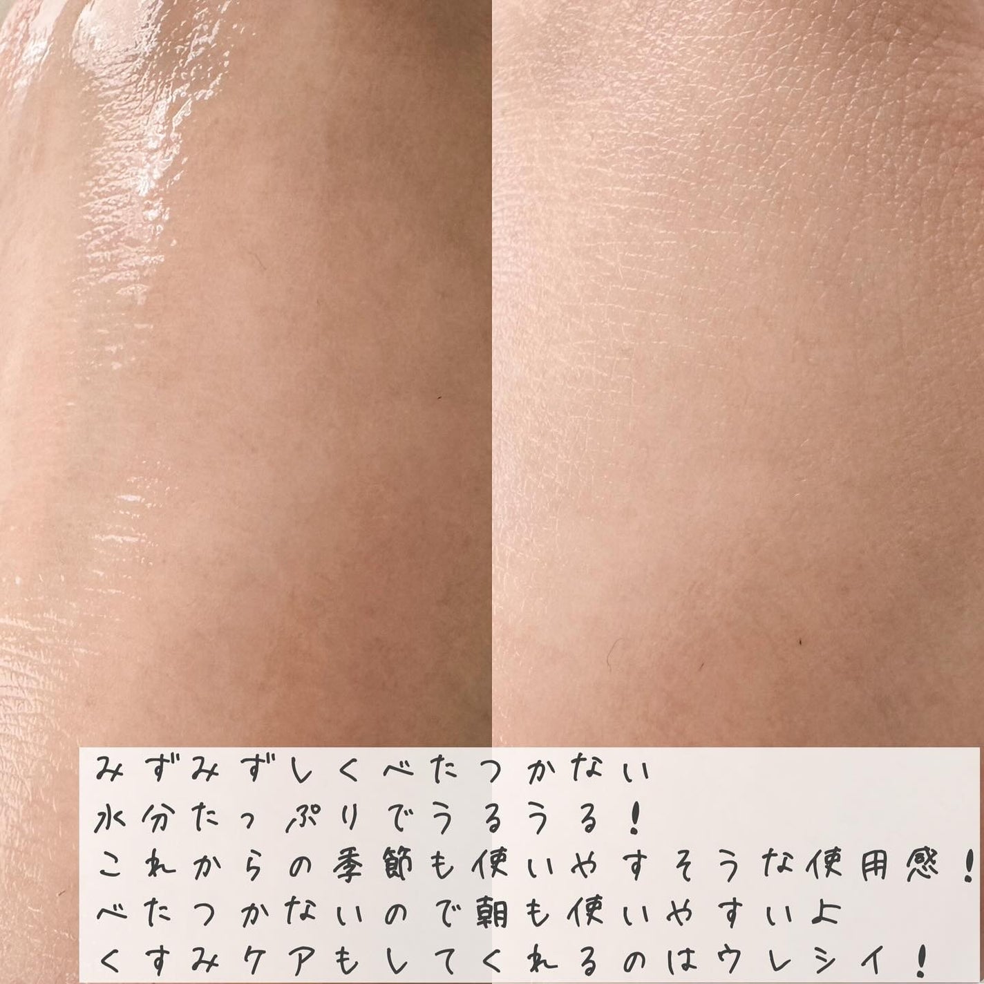 エイシカ365マイクロセラム/AESTURA/美容液を使ったクチコミ(4枚目)