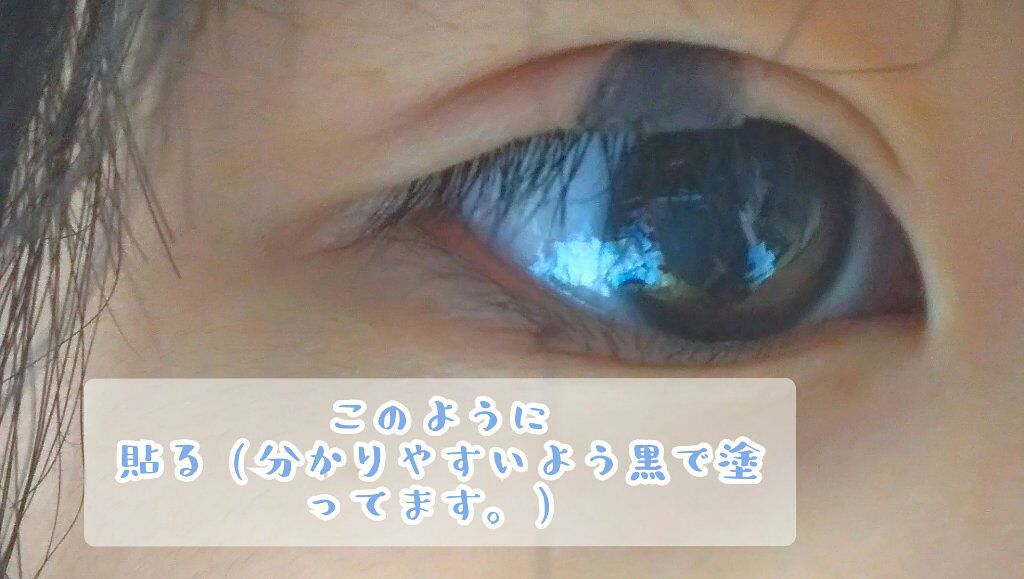 肌色タイプ/バンドエイド/その他を使ったクチコミ（3枚目）