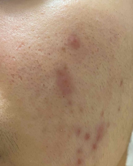 Cセラム/b.glen/美容液を使ったクチコミ(3枚目)