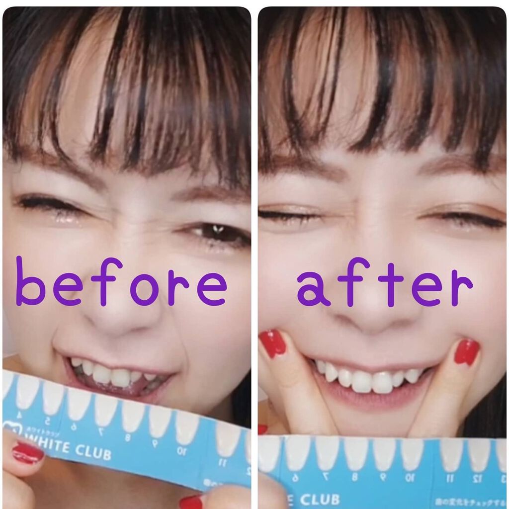 あたりちゃん♥️フォロバ&イイネ返し on LIPS 「【Dr.USB】スパークリングイレーサーホワイトニングL..」(7枚目)