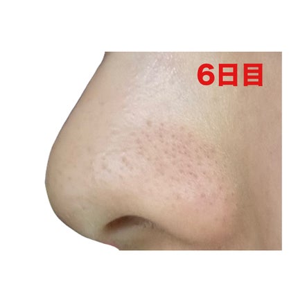 ディープクリア酵素洗顔 /メラノCC/洗顔フォームを使ったクチコミ(8枚目)