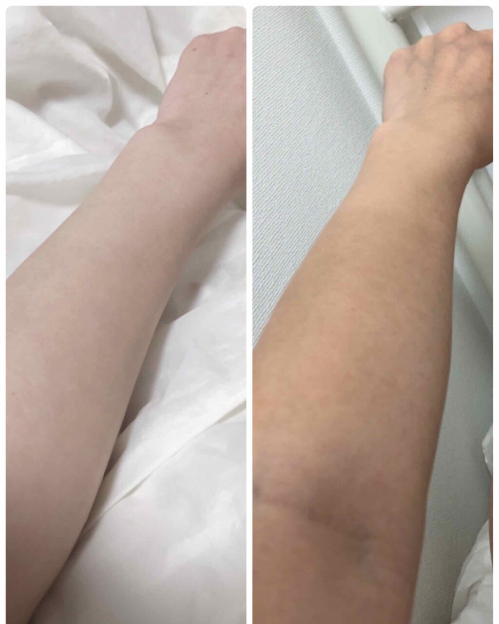 モイスチャージェル/スキンアクア/日焼け止めジェルを使ったクチコミ(2枚目)