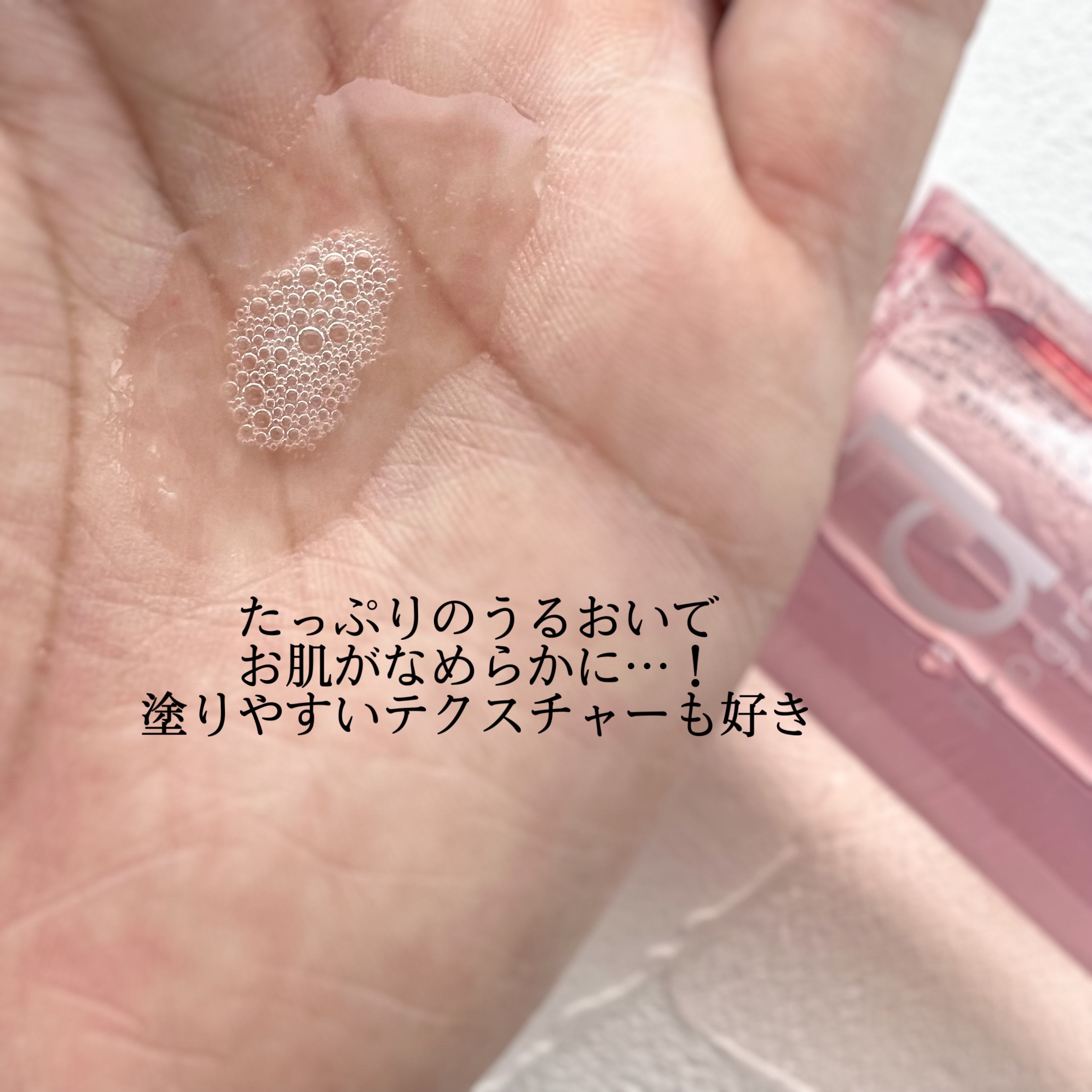 モイストケア ローション MB/d プログラム/化粧水を使ったクチコミ（2枚目）