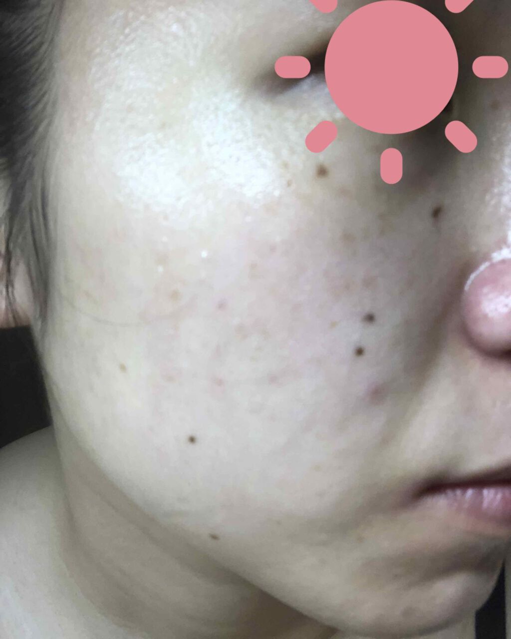 オバジC10セラム/オバジ/美容液を使ったクチコミ(1枚目)