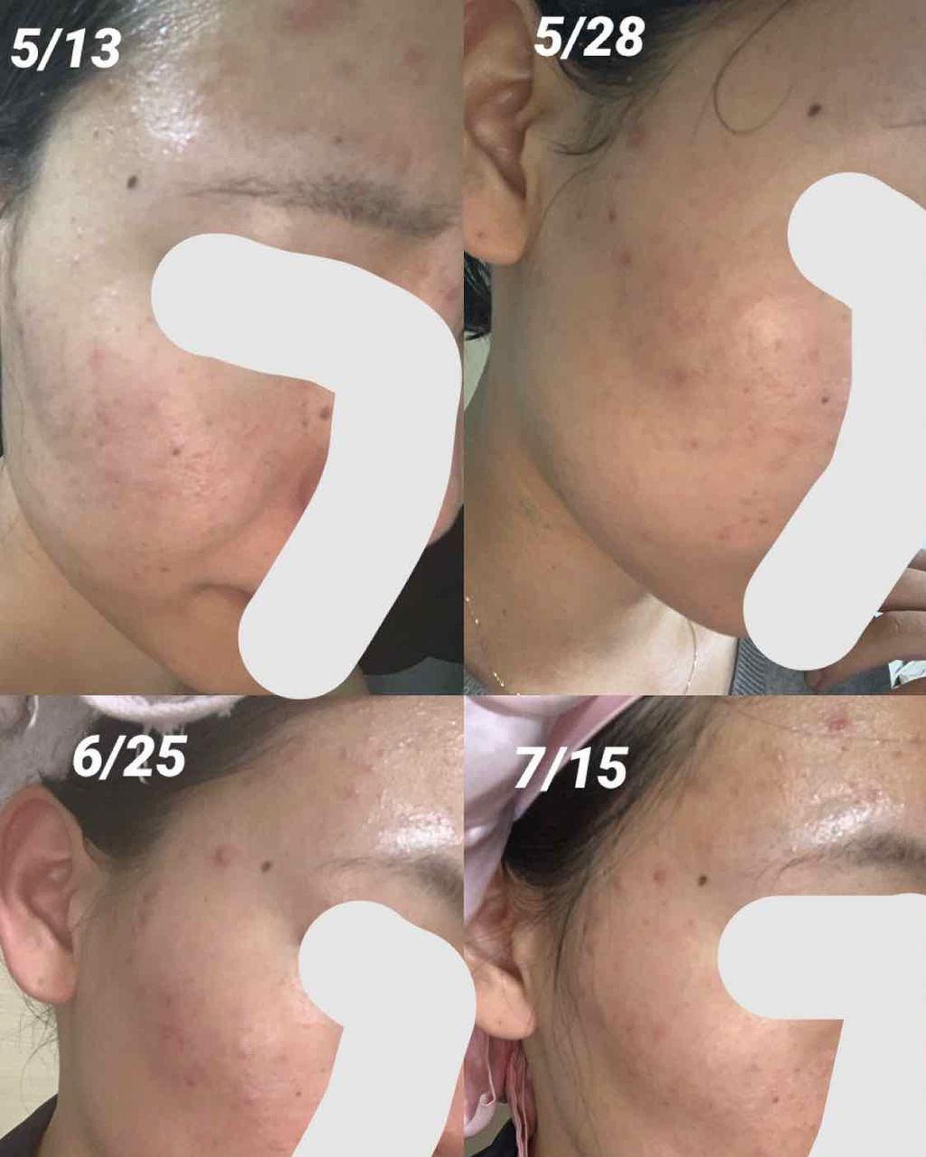 DHC はとむぎエキス/DHC/健康サプリメントを使ったクチコミ(3枚目)