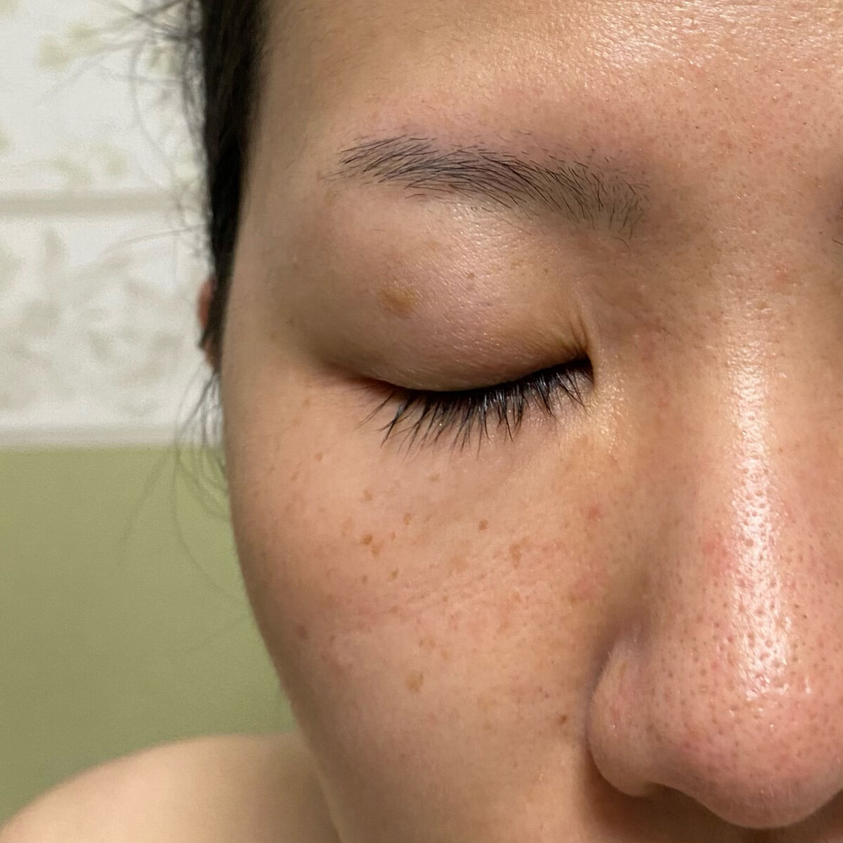 薬用シミノケア ホワイトパック/アイケイ/シートマスク・パックを使ったクチコミ（3枚目）