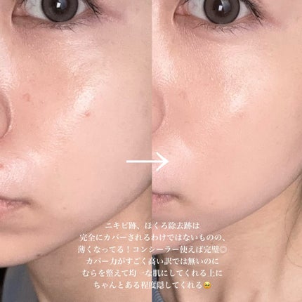 V3 エキサイティングファンデーション/SPICARE/クッションファンデーションを使ったクチコミ(7枚目)