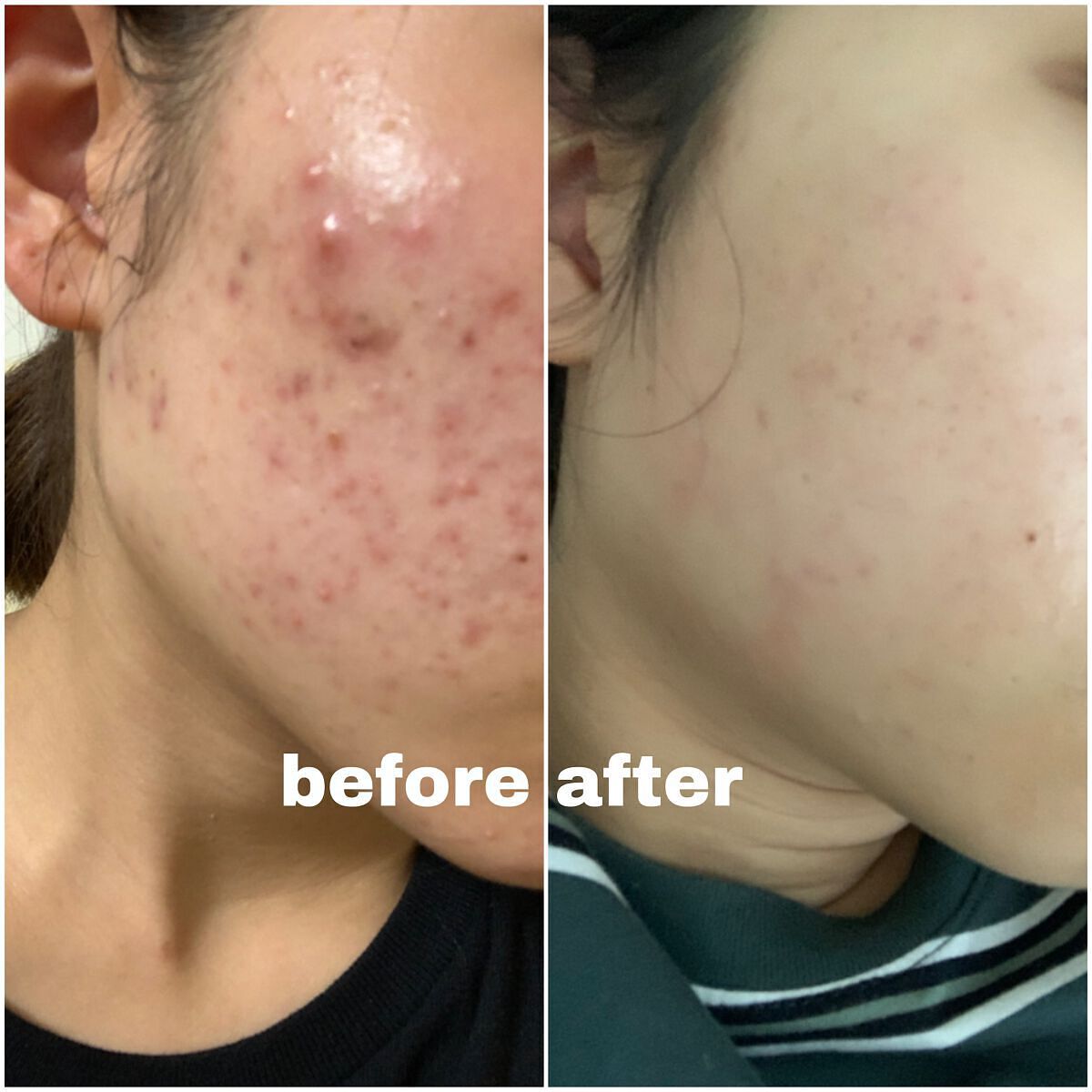 潤浸保湿 フェイスクリーム/キュレル/フェイスクリームを使ったクチコミ(1枚目)