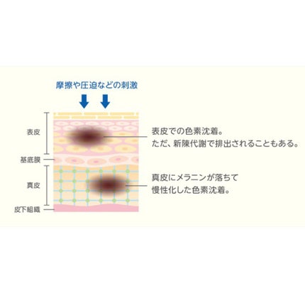サンホワイトP-1/サンホワイト/ボディクリームを使ったクチコミ(5枚目)