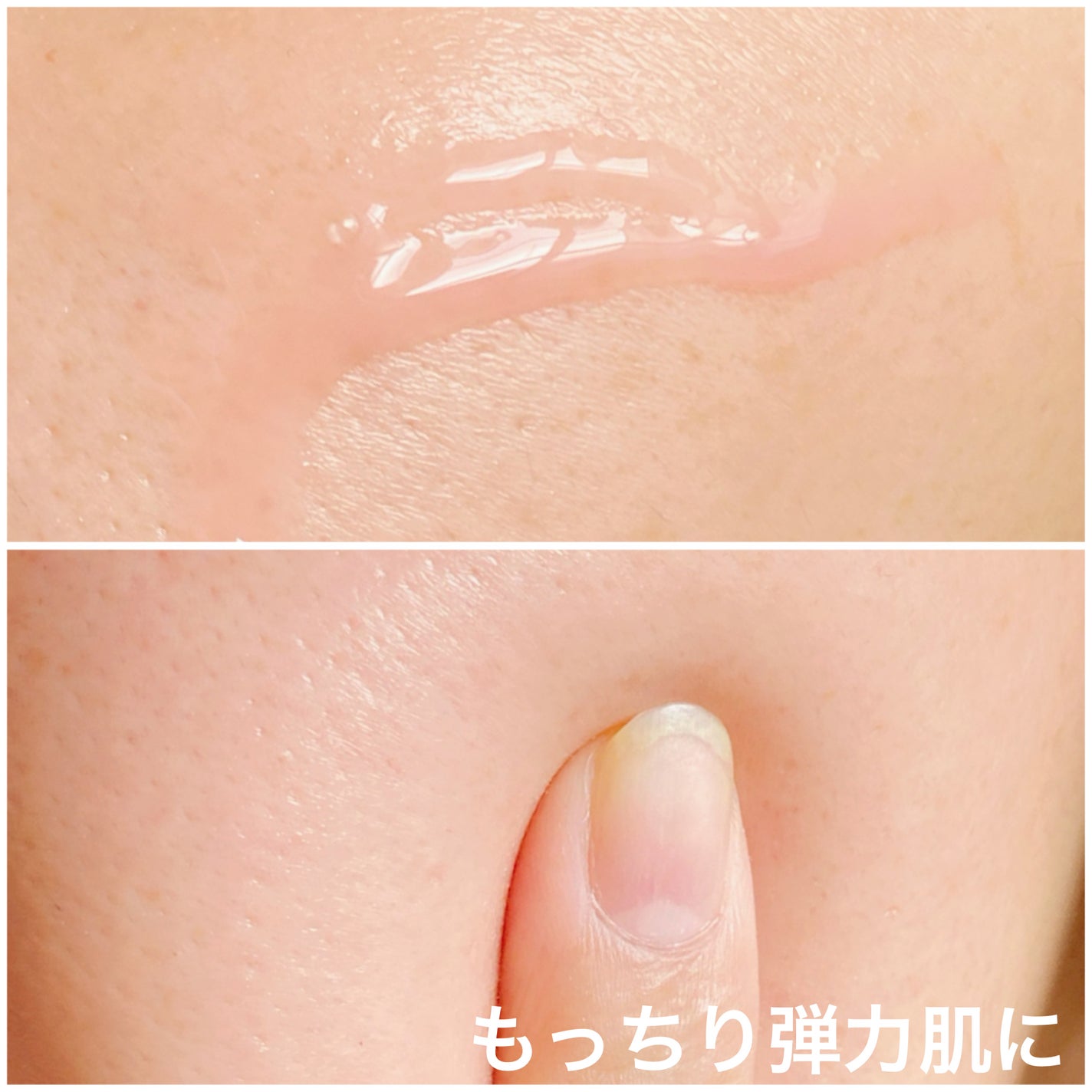 PDRNピンクアンプル PDRN 10,000ppm配合/MEDICUBE/美容液を使ったクチコミ(5枚目)