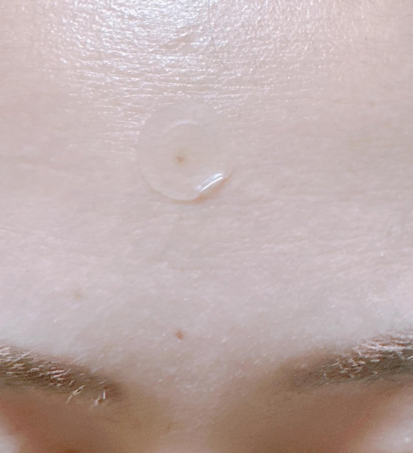 ノスカナイン スポット パッチ/FATION/にきびパッチを使ったクチコミ(5枚目)