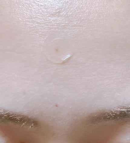 ノスカナイン スポット パッチ/FATION/にきびパッチを使ったクチコミ(5枚目)