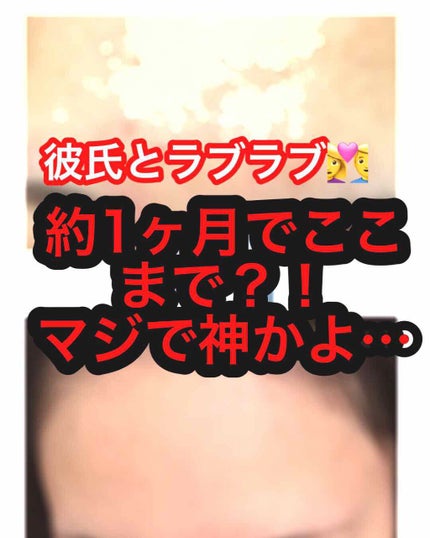 ヒアルロン酸原液/太陽のアロエ社/美容液を使ったクチコミ(1枚目)