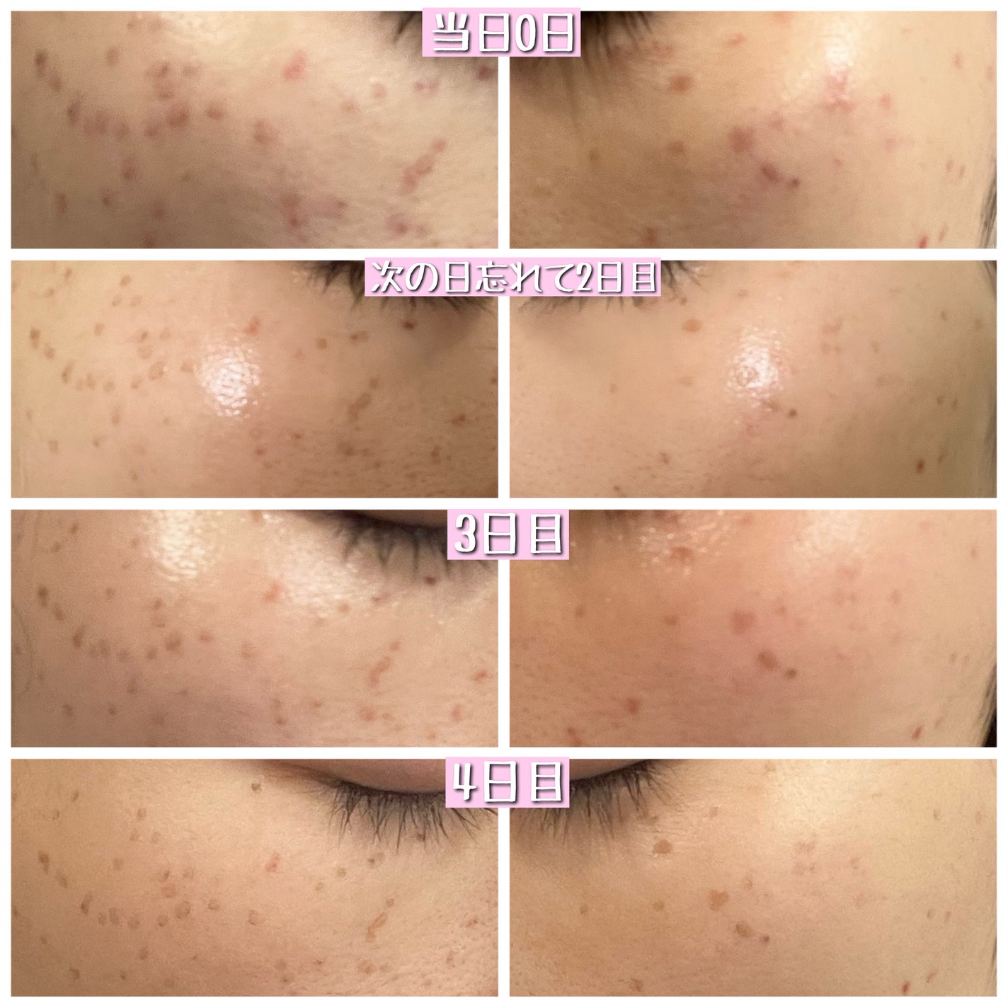 スキンブライセラム/ZO Skin Health/美容液を使ったクチコミ(2枚目)