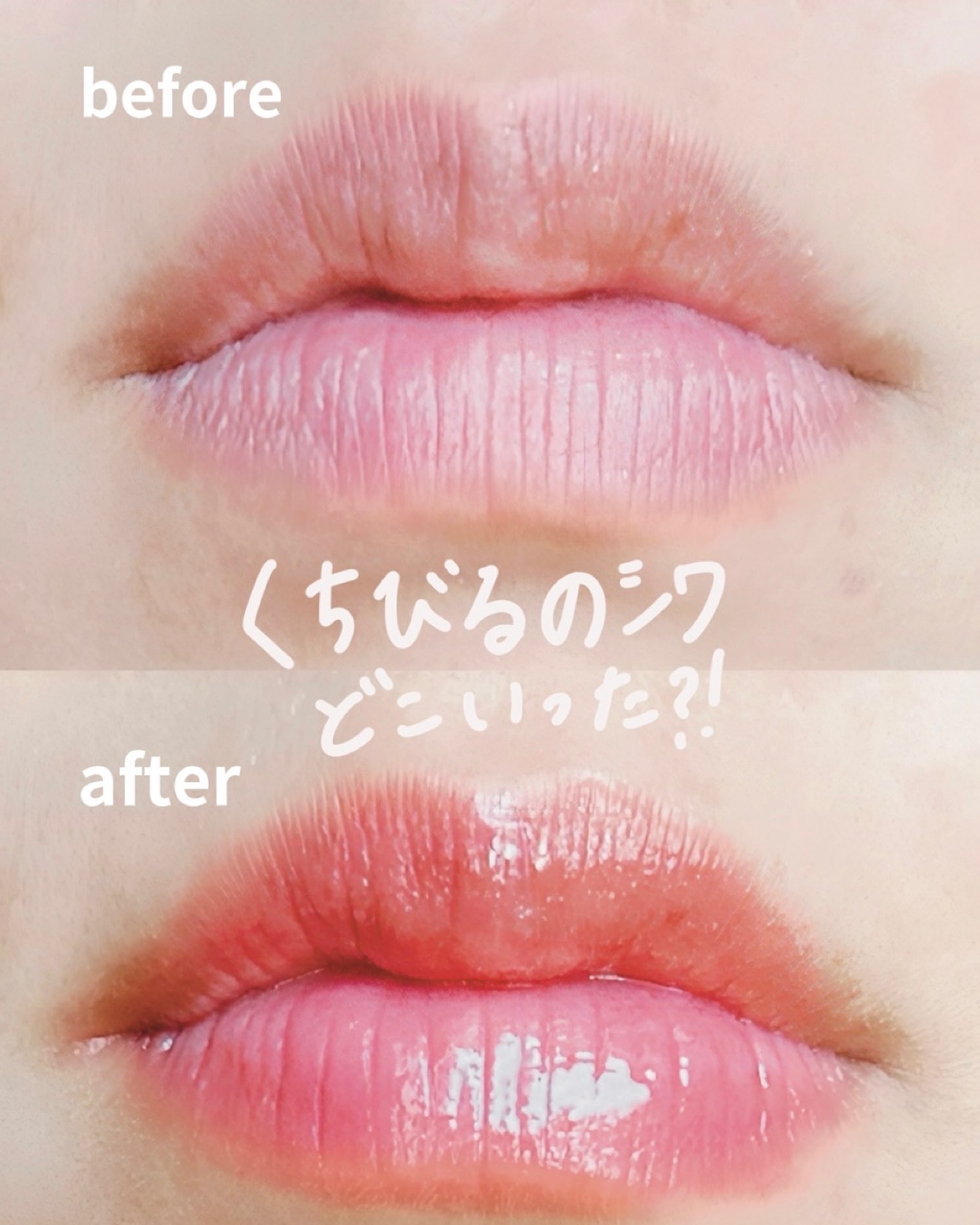 アラフォーママあここです🫡✨
 30代中盤あたりから やばいなとは思っていたんだけど。。。
 自分のくちびるが しょぼしょぼ🥲
 色も無いし シワシワだし 本当リップないと無理なのは当たり前なんだけど
 シワシワ しょぼしょぼはリップじ