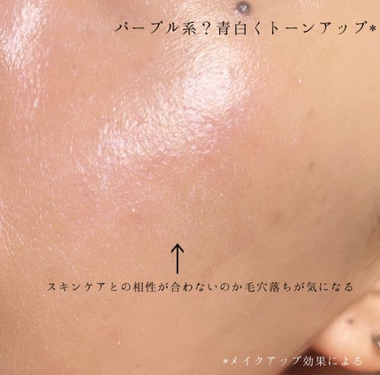 ããªã¬UVãã¢ã¯ã¢ãªãããã¢ã¯ã¢ãã€ã©ã€ãããŒã·ã§ã³ïŒæ°Žå±€ãã€ã©ã€ãUVïŒ/ããªã¬/æ¥çŒãæ¢ãããŒã·ã§ã³ã䜿ã£ãã¯ãã³ãïŒ4æç®ïŒ