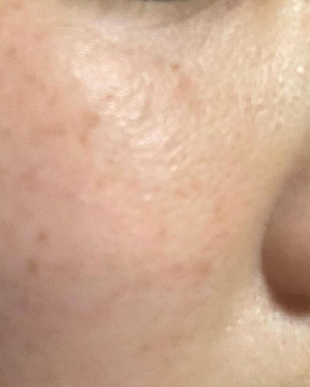 タカミスキンピール/タカミ/ブースター・導入液を使ったクチコミ(5枚目)