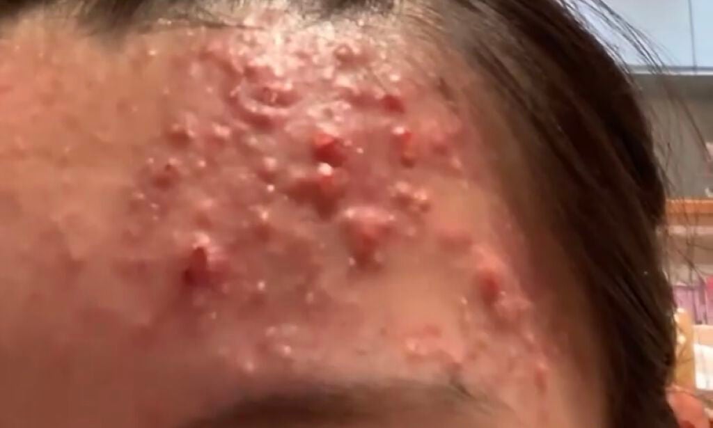 化粧水・敏感肌用・高保湿タイプ/無印良品/化粧水を使ったクチコミ(3枚目)